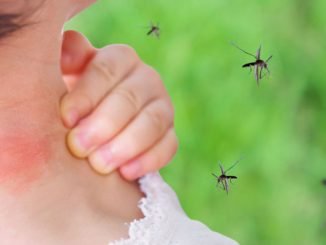 Mückenstich behandeln